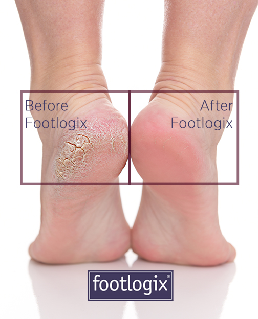 Footlogix - Where MEDI meets PEDI